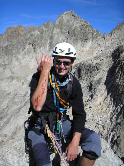 Suite à d'une chute qui aurait pu plus mal se terminer !